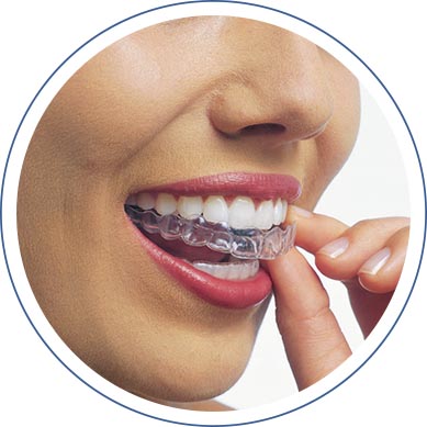 Invisalign®